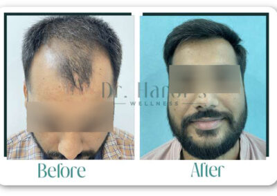 Before & After