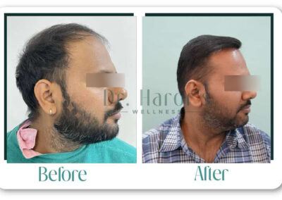 Before & After