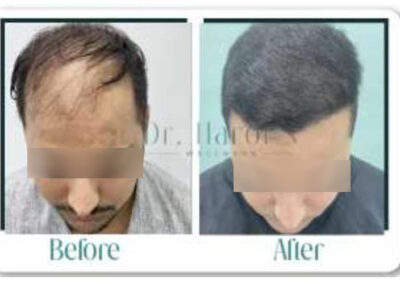 Before & After