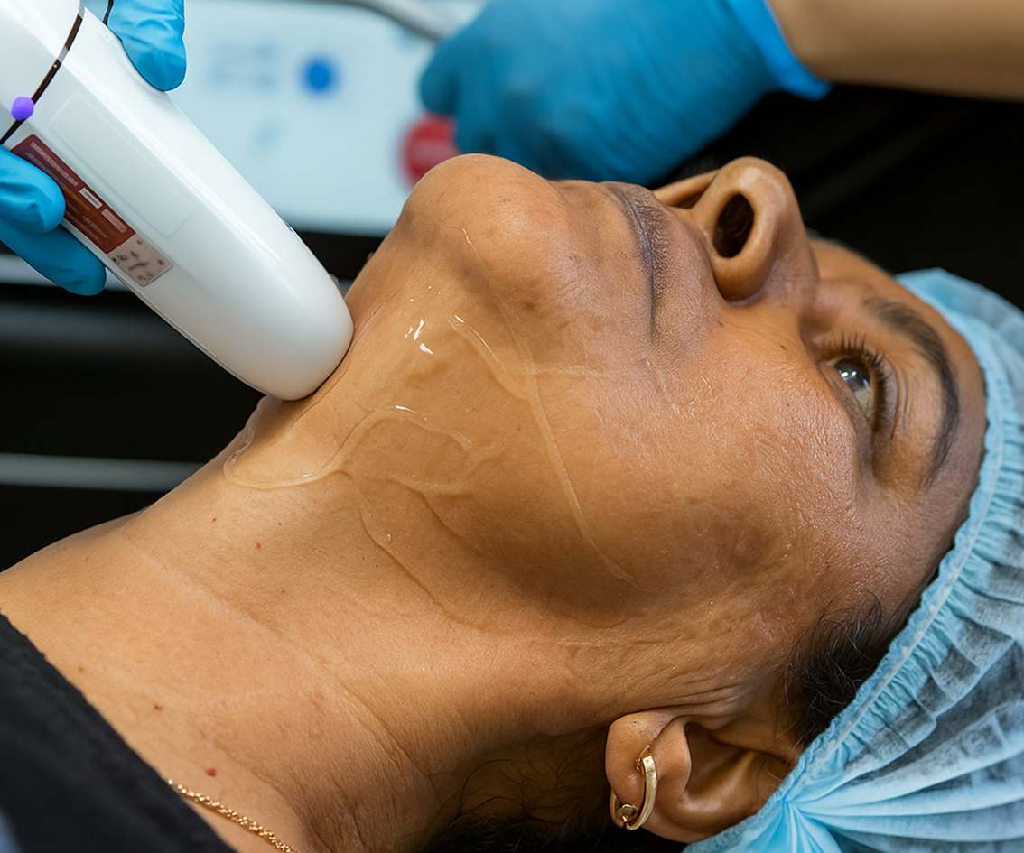 What to Expect During the Procedure-st-mbl-img What to Expect During the Procedure-st-mbl-img