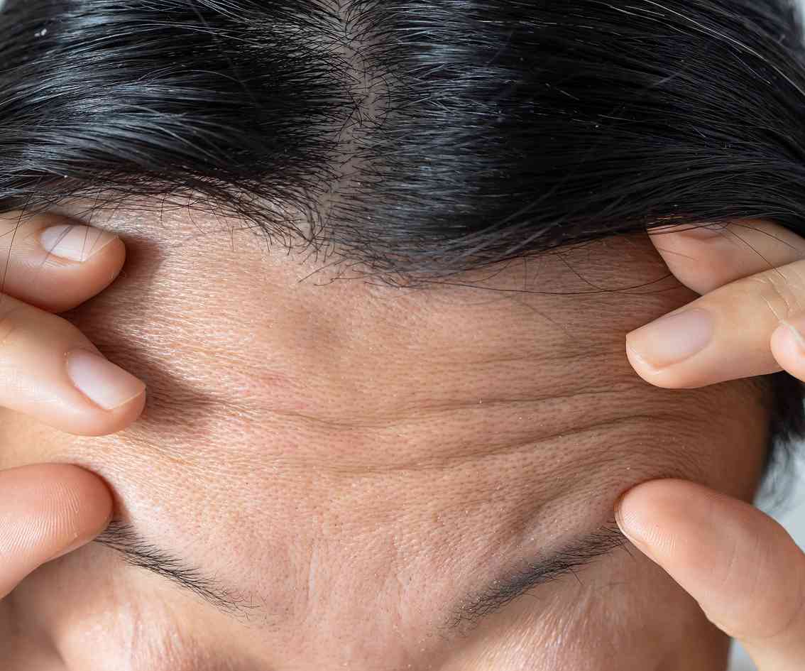 Who is Anti-Aging Treatment Ideal For-mbl-img Who is Anti-Aging Treatment Ideal For-mbl-img