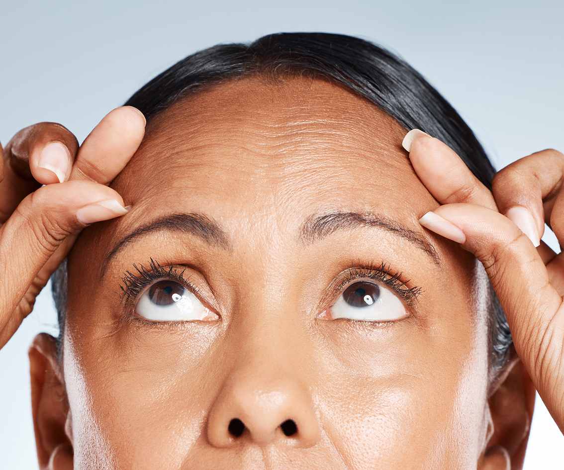 Who is Botox Ideal For-mbl-img Who is Botox Ideal For-mbl-img