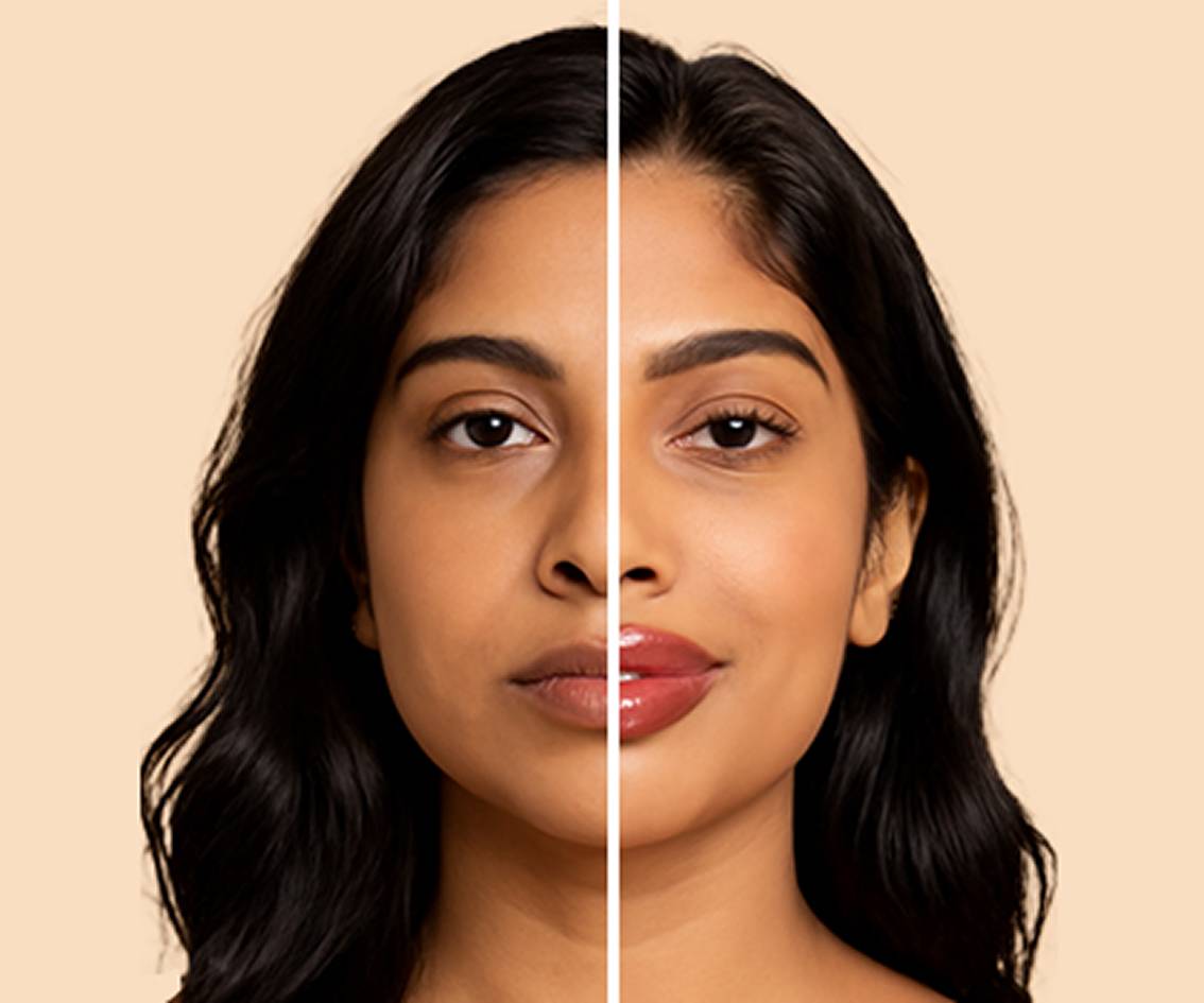 Who is LIp Fillers Ideal For-mbl-img Who is LIp Fillers Ideal For-mbl-img
