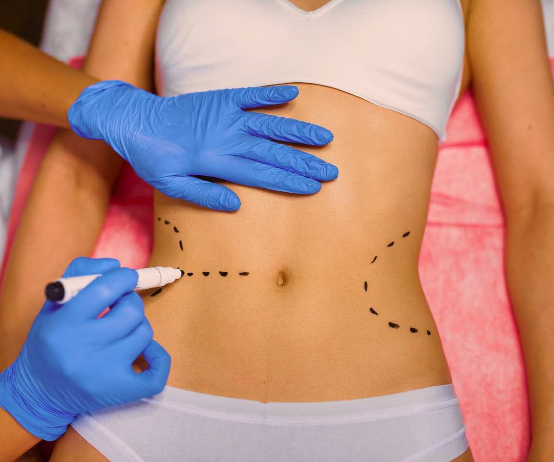 Aesthetic Body Procedures Aesthetic Body Procedures