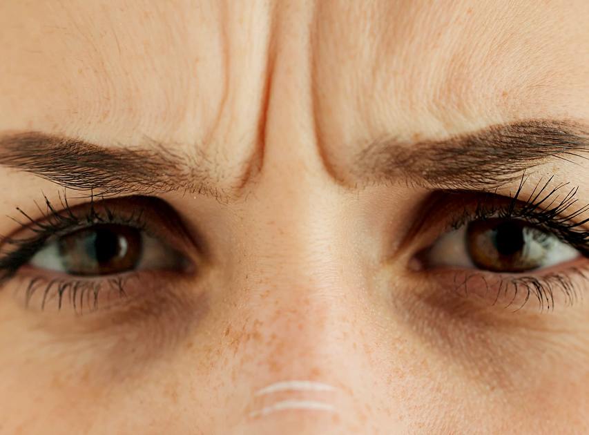 Areas Treated with Anti-wrinkle Treatment | Dr. Haror's Wellness