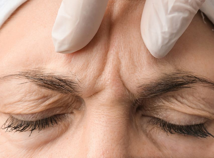Areas Treated with Botox | Dr. Haror's Wellness