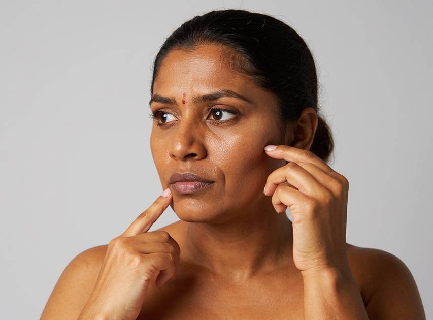 Areas Treated with Skin Rejuvenation | Dr. Haror's Wellness