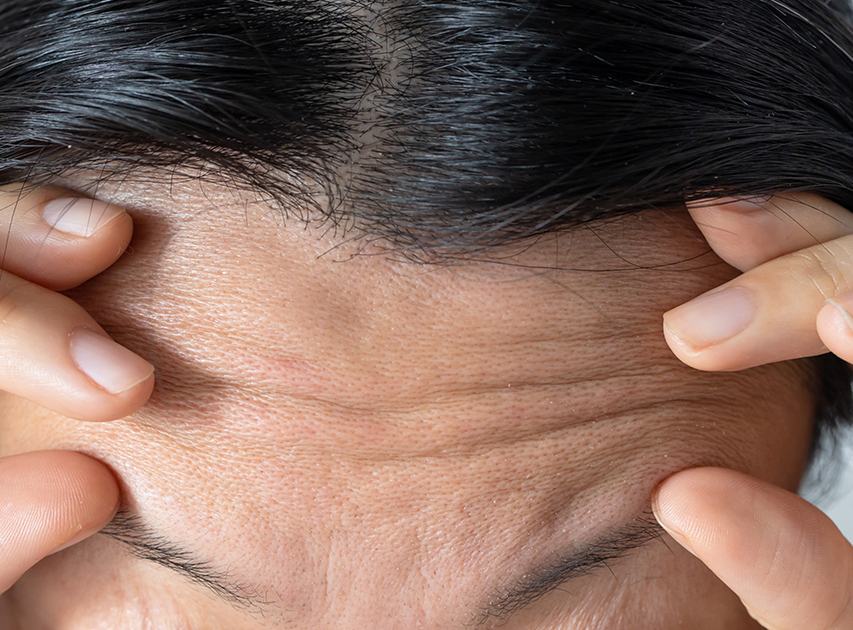 Candidates for Anti-Aging Treatment | Dr. Haror's Wellness