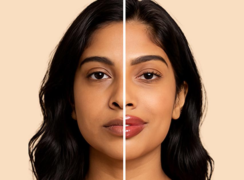 Candidates for Lip Fillers | Dr. Haror's Wellness