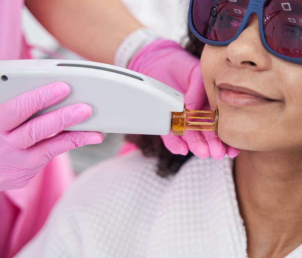 Common Myths About Fractional CO2 Lasers | Dr. Haror's Wellness
