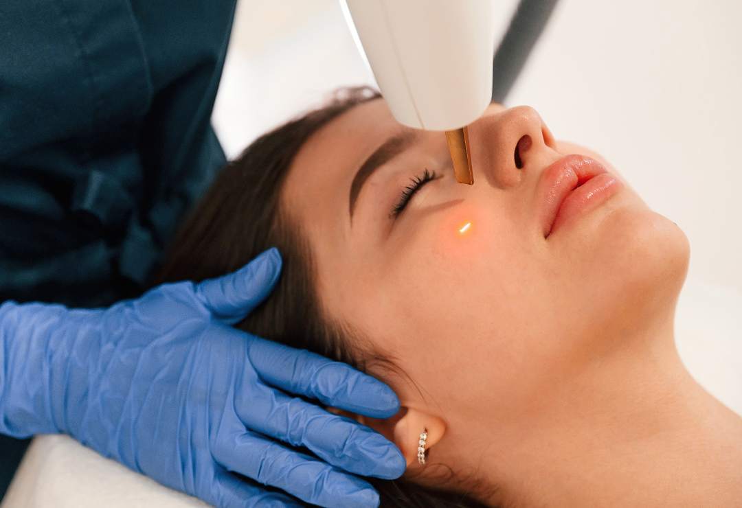 Facial Pigmentation | Dr. Haror's Wellness