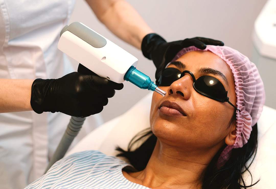 Fractional CO2 Lasers banner | Dr. Haror's Wellness