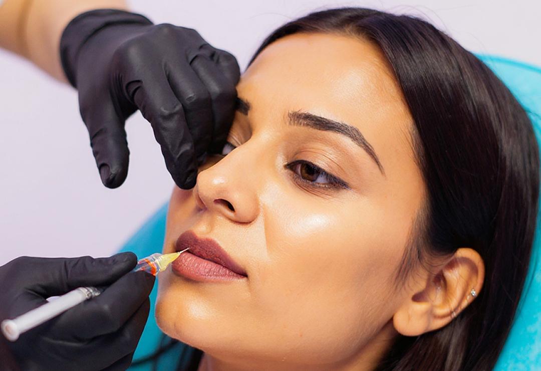 Lip Fillers banner | Dr. Haror's Wellness