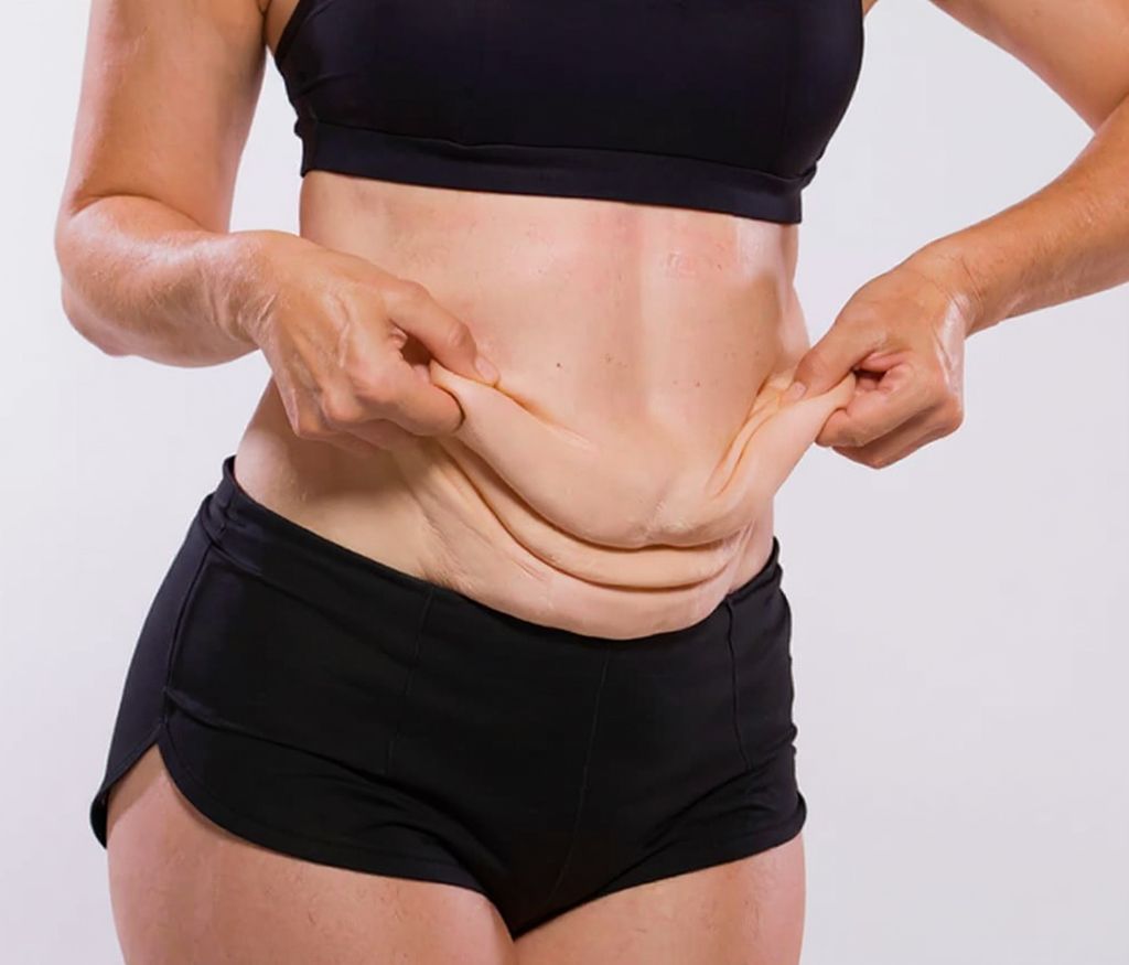 Myths About Skin Tightening Treatment Myths About Skin Tightening Treatment
