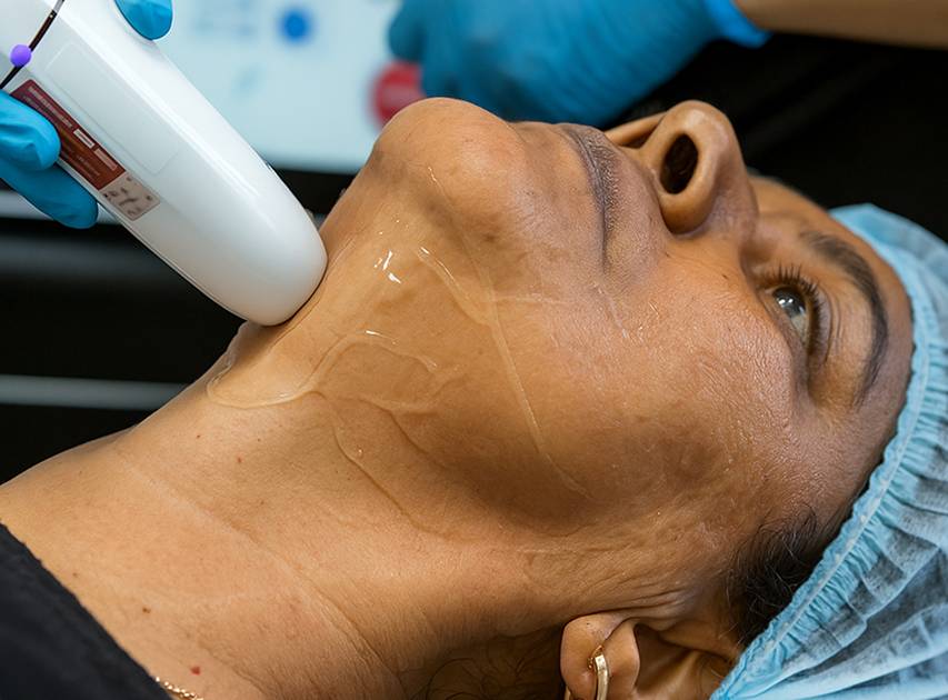What to Expect During Skin Tightening | Dr. Haror's Wellness What to Expect During Skin Tightening | Dr. Haror's Wellness